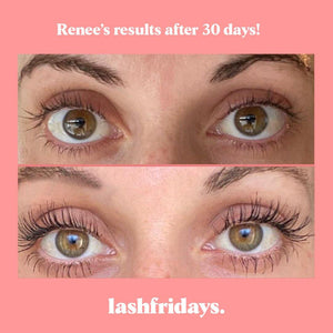 Pick 3 Serums & Save 30% Set