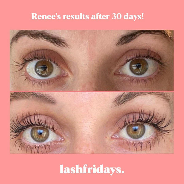 Pick 3 Serums & Save 30% Set